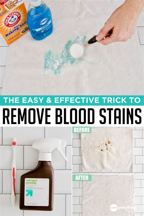 hydrogen peroxide remove blood